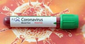 Coronavirus, il bollettino di oggi in Italia: 23.477 nuovi casi e 555 decessi